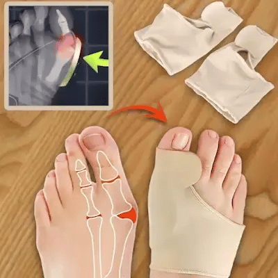 Corector Ortopedic pentru Monturi FootFix™